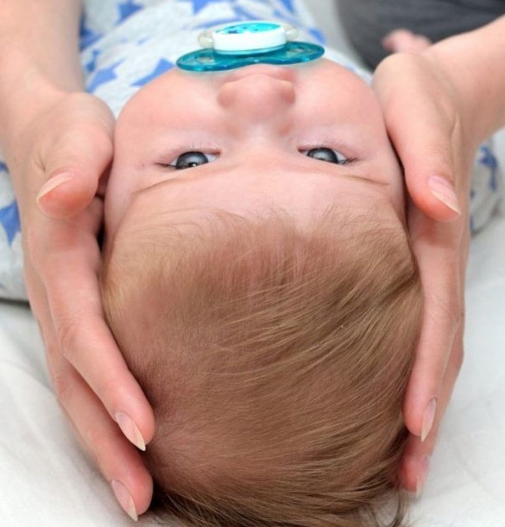 Изображение карточки: Швы черепа у младенца