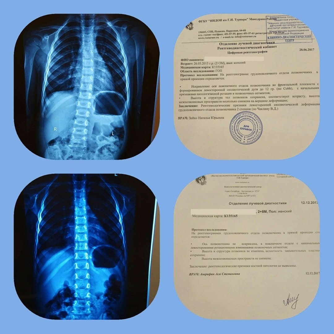 Изображение карточки: Случай из практики