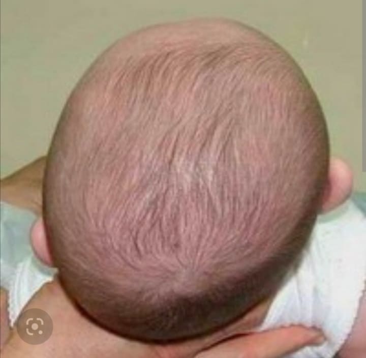 Изображение карточки: Асимметрия головы у ребёнка