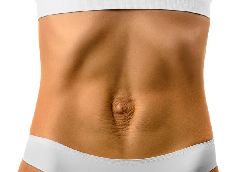 Изображение карточки: Диастаз (расхождение) прямых мышц живота